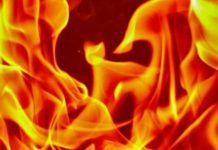 തീപിടുത്തത്തിൽ നിന്ന് ഭാര്യയെ രക്ഷിക്കാൻ ശ്രമം: യുഎഇയിൽ മലയാളിക്ക് ഗുരുതര പരിക്ക്