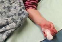 നഴ്സറിയിൽ വെച്ച് ഉണ്ടായ അപകടത്തിൽ കുട്ടിയുടെ വിരൽ നഷ്ടപ്പെട്ടു