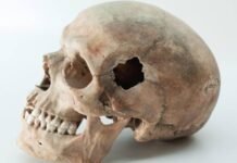 കോഴിക്കോട് മെഡിക്കൽ കോളജ് പരിസരത്ത് തലയോട്ടിയും അസ്ഥികളും കണ്ടെത്തി