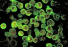 സംസ്ഥാനത്ത് വീണ്ടും അമീബിക് മസ്തിഷ്ക ജ്വരം; രോഗം സ്ഥിരീകരിച്ചത് വയനാട് സ്വദേശിക്ക്