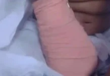 ഒന്പത് വയസുകാരിയുടെ കൈമുറിച്ചു മാറ്റേണ്ടി വന്ന സംഭവം; ചികിത്സാ പിഴവ് ഇല്ലെന്ന് ആവര്ത്തിച്ച് അധികൃതര്