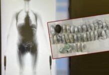 യാത്രക്കാരന്റെ ശരീരത്തിനുള്ളിൽ ഹാഷിഷ് കടത്താനുള്ള ശ്രമം കുവൈറ്റ് കസ്റ്റംസ് പരാജയപ്പെടുത്തി